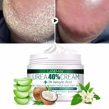 Herbal Anti Crack Foot Cream Heel Cracking Repair Products Exfoliation Dead Skin Removal Softening Moisturize Smooth Skin Care