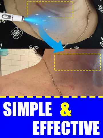 The latest scar removal technology, remove scars in 7 days