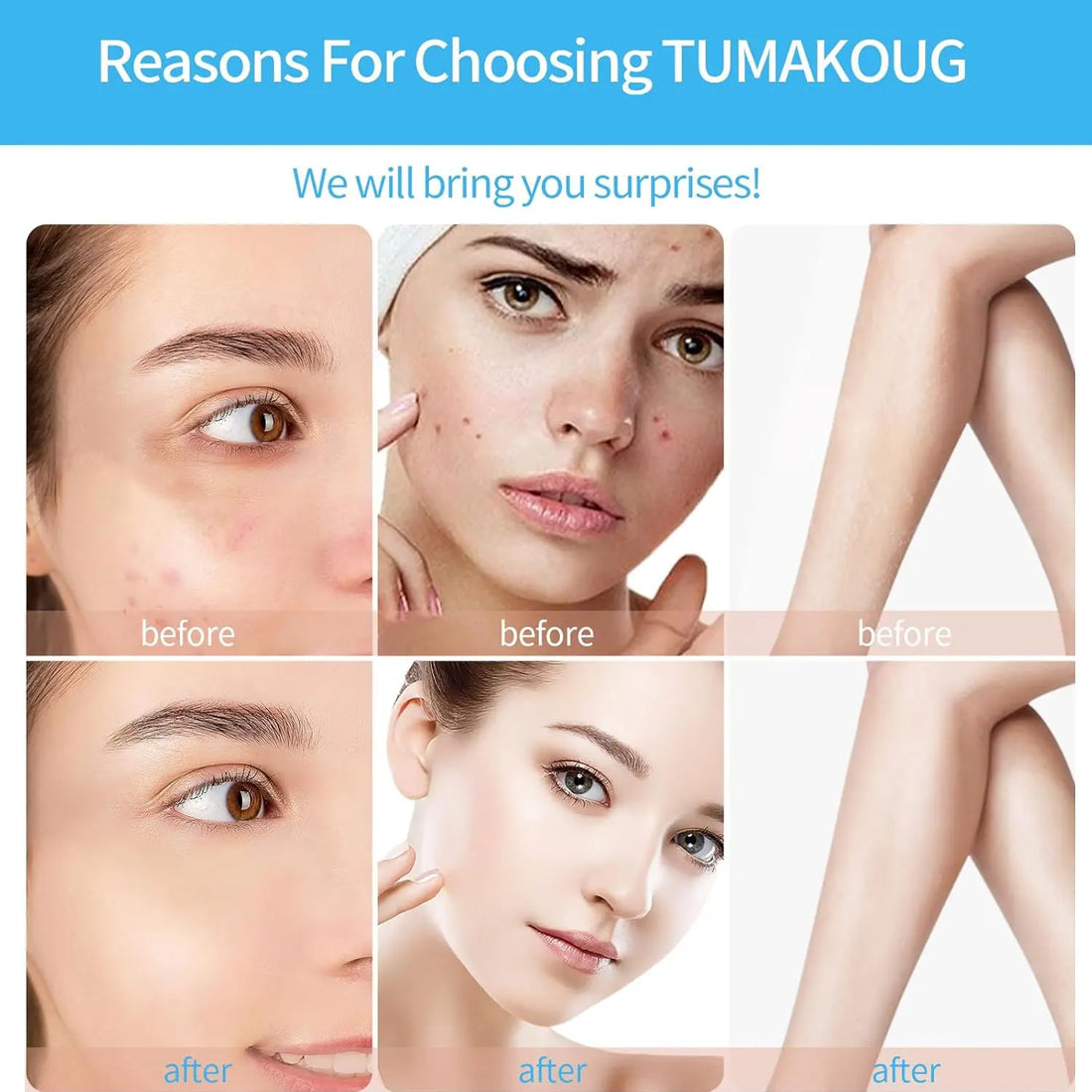 4 in 1 High Frequency Skin Therapy Wand Machine Microcurrent Massage Skin Rejuvenation Tightening Wrinkle Reducing Tool
