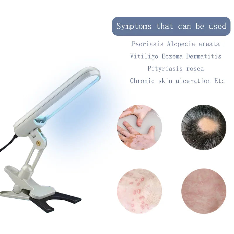 UVB Light for the treatment of vitiligo psoriasis Skin Treatment Light 311nm narrow band ultraviolet UV light for the treatment
