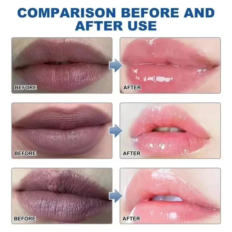 Remove Dark Lip Balm Lightening Melanin Mask Gloss Oil Exfoliating Clean Moisturizer Korean Care Products Makeup Beauty Health