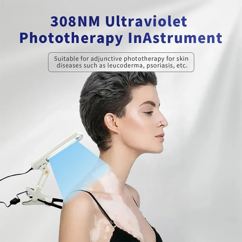 UVB Light for the treatment of vitiligo psoriasis Skin Treatment Light 311nm narrow band ultraviolet UV light for the treatment
